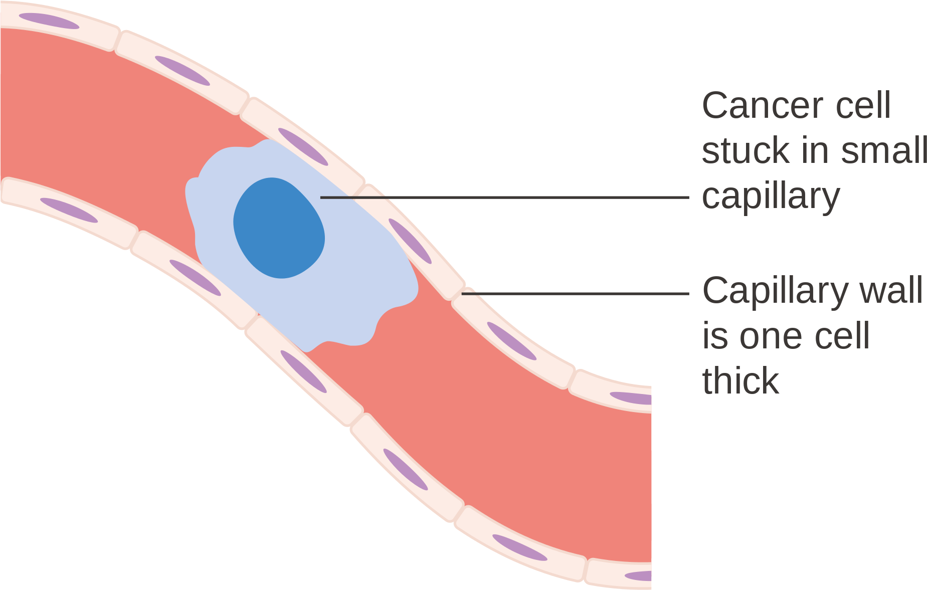 Open - Capillary Cancer (2000x1360), Png Download