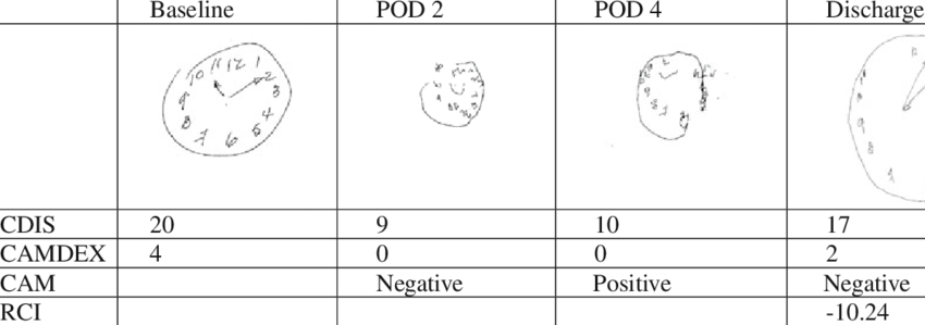 Representative Clock Drawing Tests And Related Scores - Drawing (850x299), Png Download