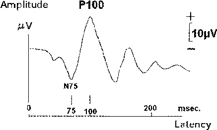 The Wave Pattern Of Pr-vep - Wave (450x284), Png Download