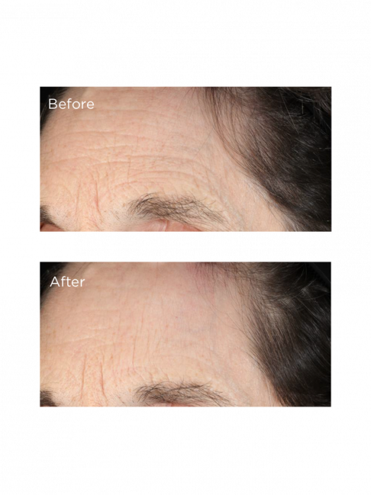 Perricone Md Essential Fx Deep Crease Serum 213119 - Eyelash (525x700), Png Download