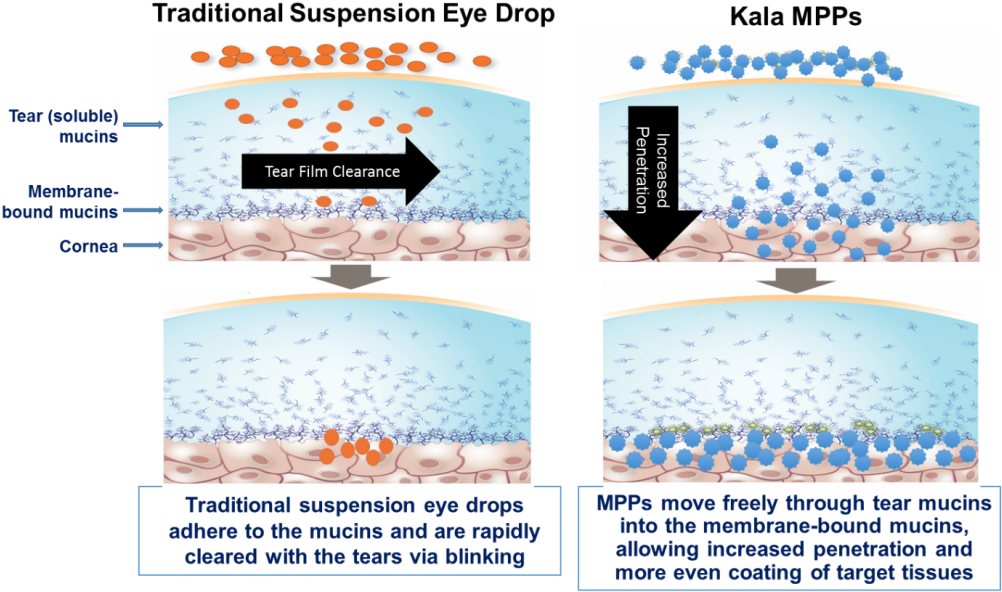 This Graphic Is Included For Illustrative Purposes - Kala Pharmaceuticals (1024x609), Png Download