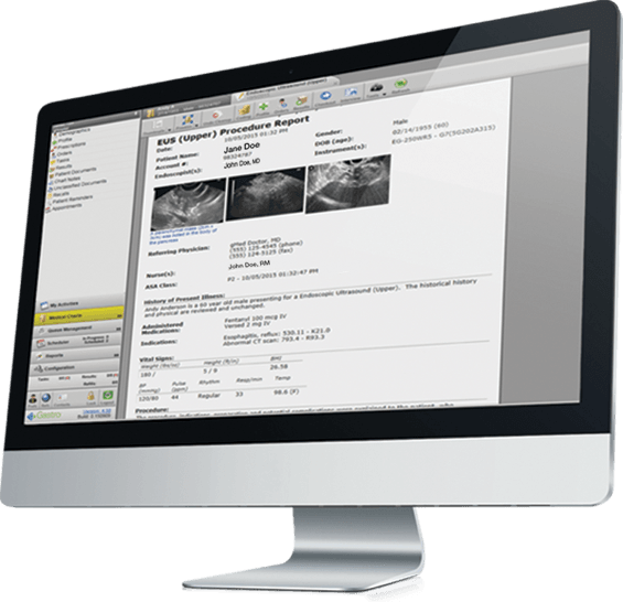 Endoscopy Report Writer On Imac - Computer Monitor (565x546), Png Download