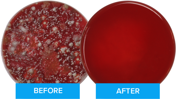 This Image Of The Petri Dishes Shows The Results Of - Phonesoap 3 - Aqua (599x376), Png Download