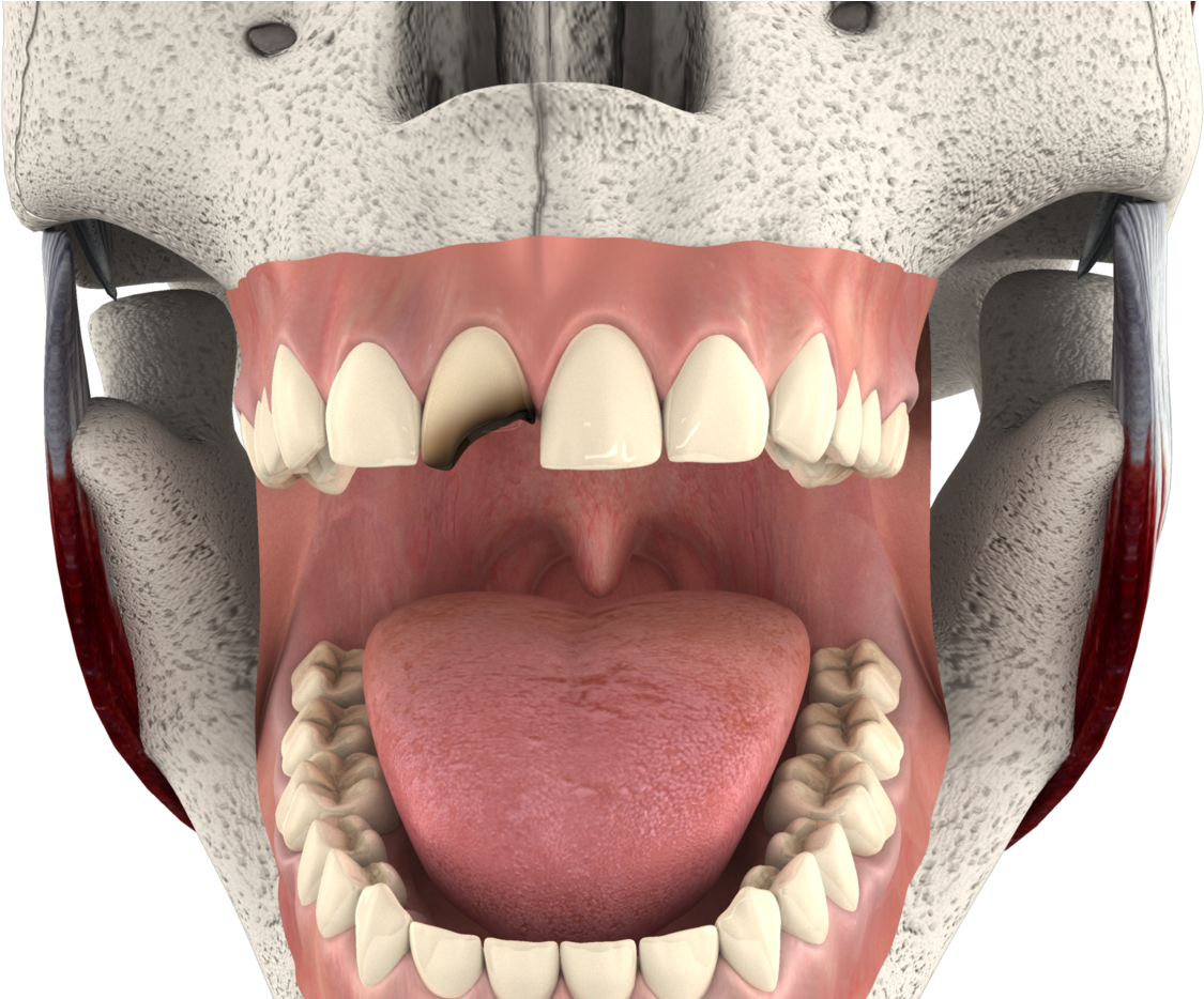Tongue (1400x933), Png Download