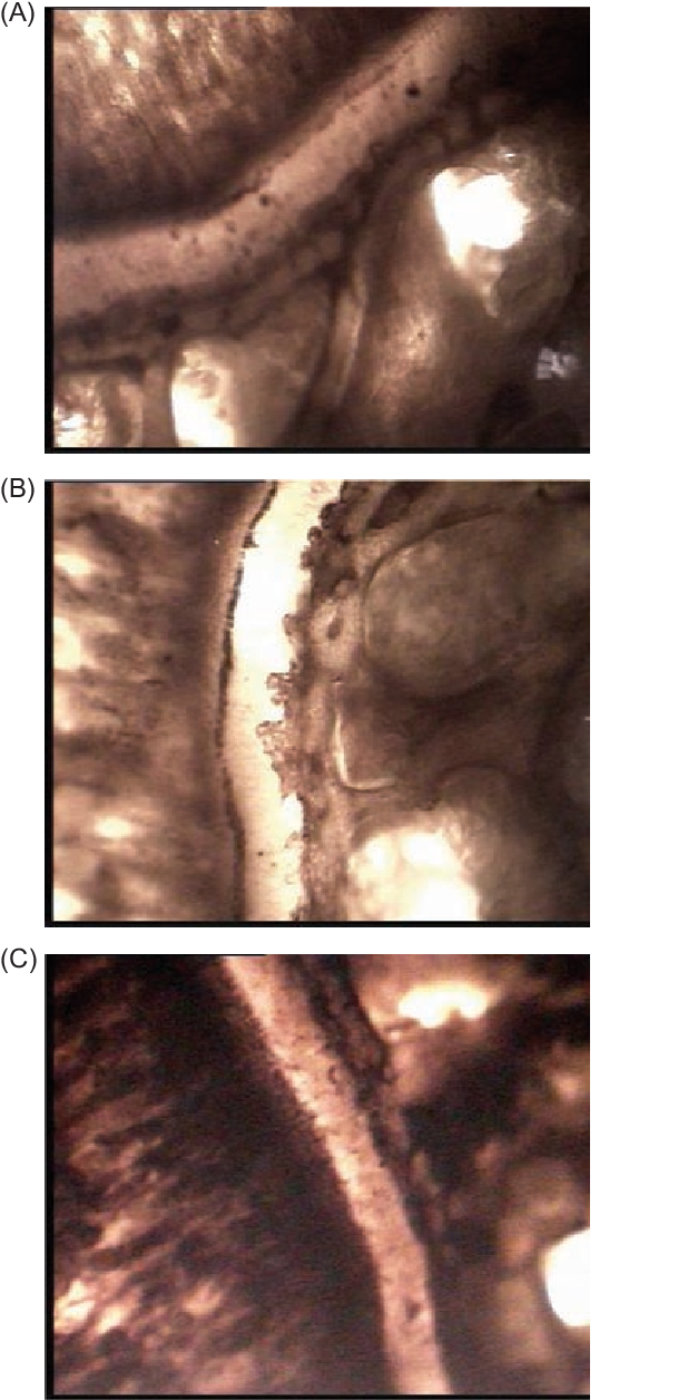 Effect Of Alcohol And Aqueous Extracts Of Young Prop - Medical Imaging (666x1258), Png Download
