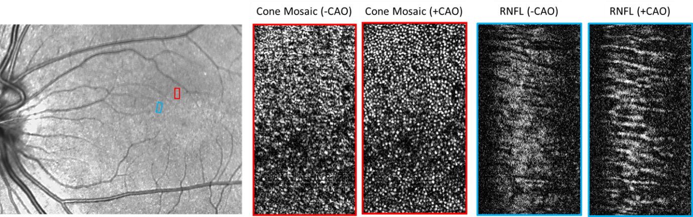 This Image Consists Of Three Black And White Pictures - Optical Fibers Retina Adaptive Optics (1381x433), Png Download