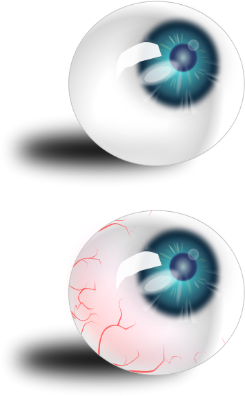 Eyeball Blue & Bloodshot Clipart Png For Web - Blue Eyeball (400x600), Png Download