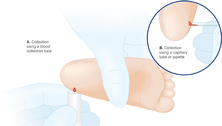 Expert Tip - Capillary (870x567), Png Download