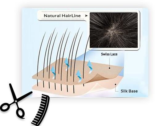 Hair Replacement For Men-hair Loss Solutions Newhairline - Hair Transplantation (503x408), Png Download