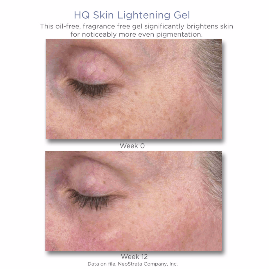Download - Neostrata Spot Lightening Results (1920x925), Png Download