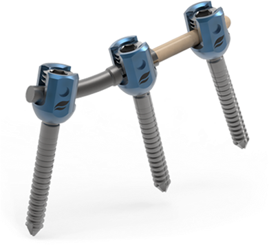 Biomech Total Spine Solution, Innovative, Quality Assurances - Spine Rod (420x465), Png Download