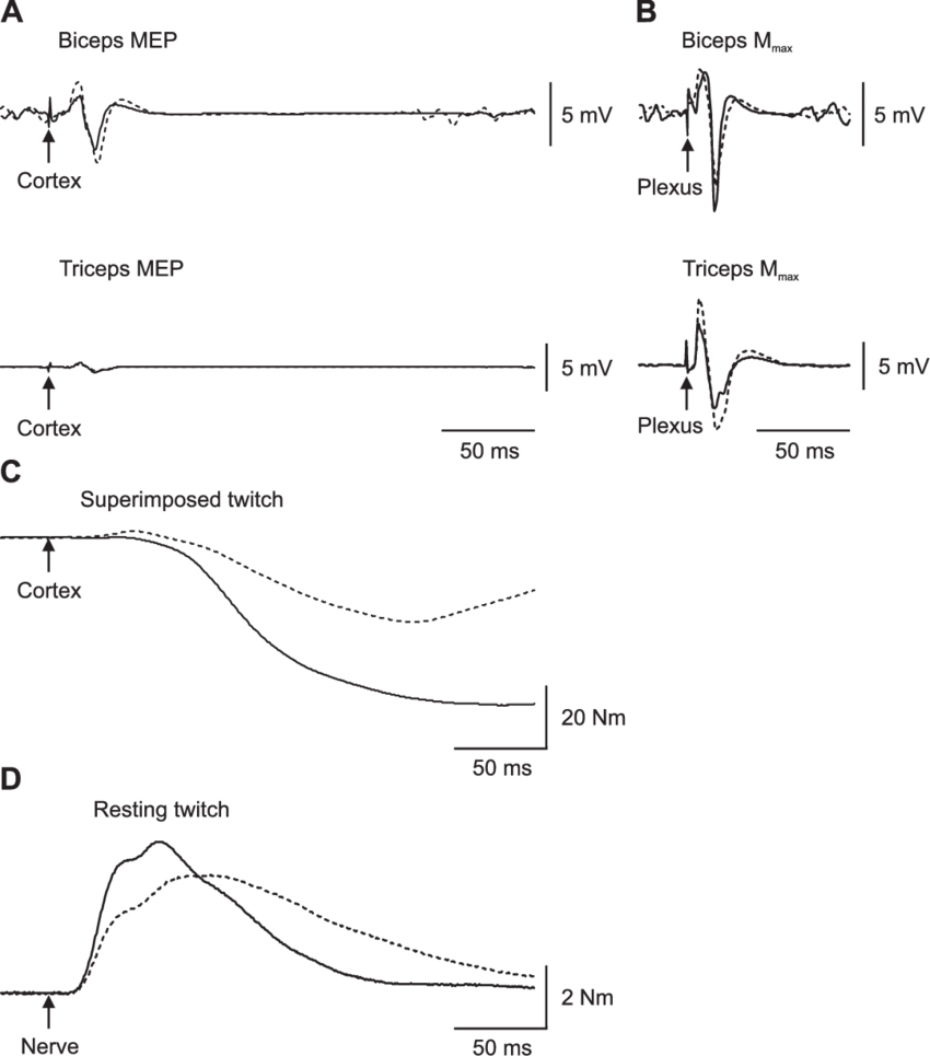 Average Traces Of Emg And Torque Responses To Stimulation - Compound Muscle Action Potential (850x965), Png Download