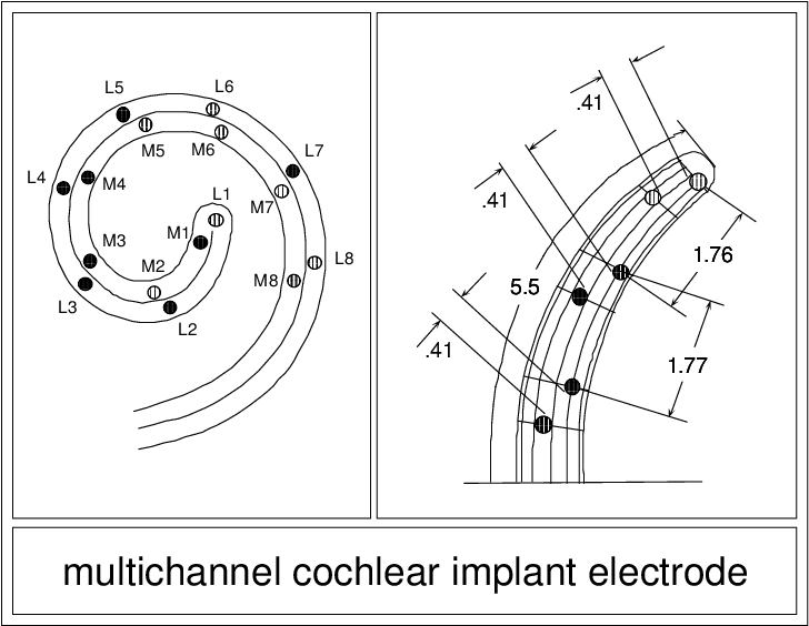 Schematic Illustration Of An Intracochlear Multichannel - Diagram (728x564), Png Download