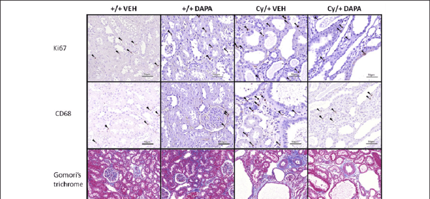 Histological Analysis For Ki67, Cd68 And Interstitial - Cd68 (850x393), Png Download