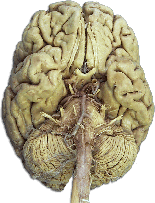 Anatomy Of Real Brain Cranial Nerves Quiz At Bes On - Nervios Craneales Anatomia (648x848), Png Download