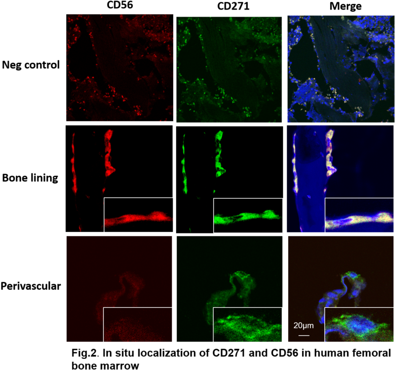 1 Fig - Filipin Stain Of Adipocyte (827x768), Png Download