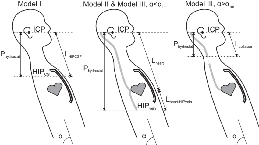 Illustration Of The Three Models Of The Effect Of Posture - Drawing (850x478), Png Download