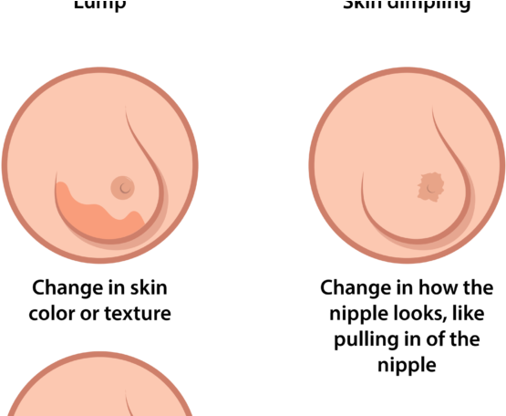 Breast Cancer Is A Woman's Greatest Fear, But Also - Play Button Icon (690x455), Png Download