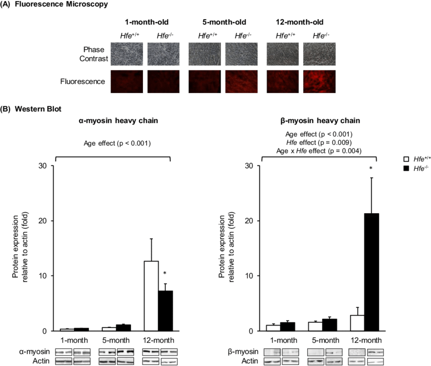 Effect Of Age On The Expression Of Cardiac Myosin Heavy - Diagram (850x723), Png Download