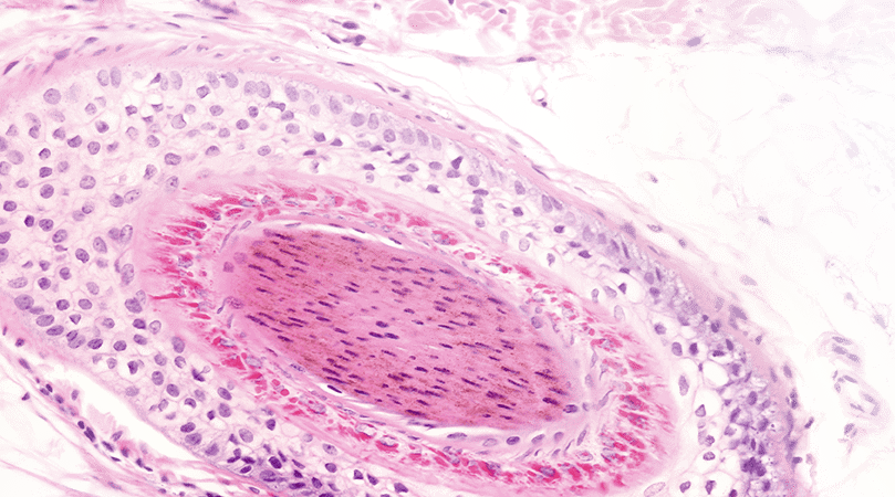 Hair Follicle Cross Section - Close-up (809x450), Png Download