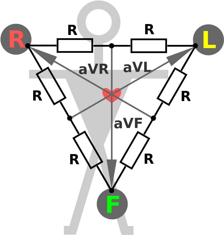 Open - Ekg Princip (2000x1500), Png Download