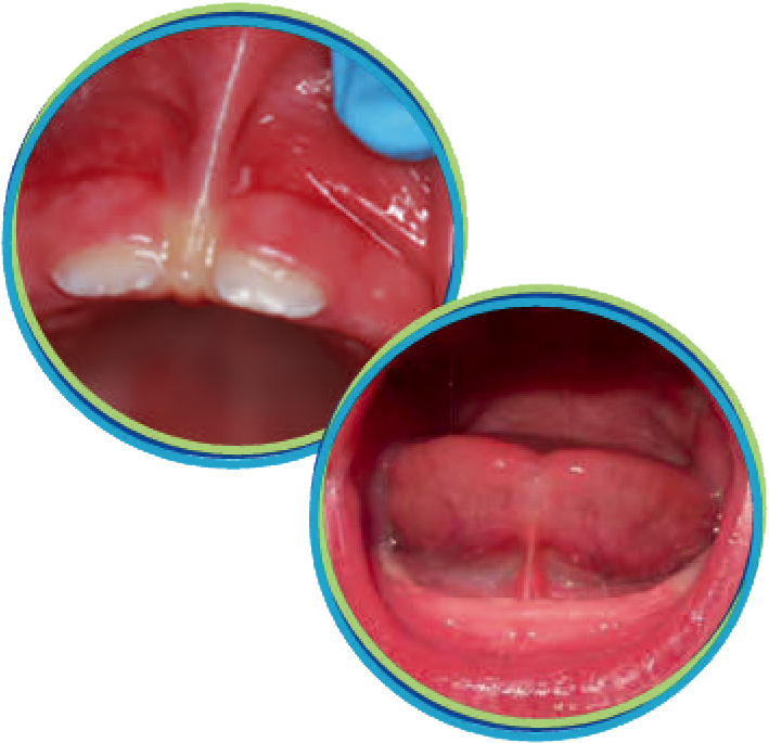 The Services We Offer - Tongue Tied Baby (730x730), Png Download