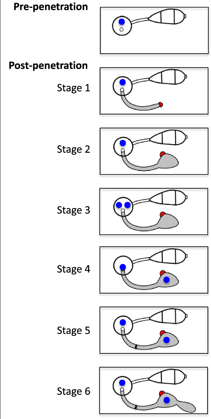 Schematic Diagram Of Early Post Penetration Growth - Diagram (689x1335), Png Download