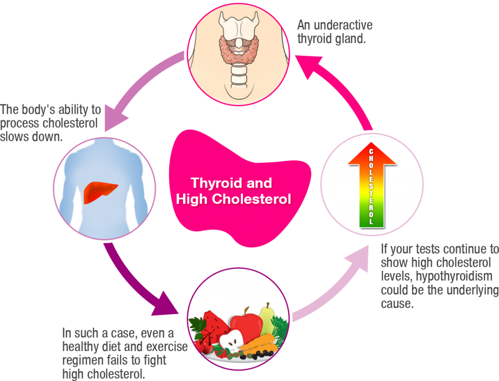Picture Of A Fat Person - Thyroid And Cholesterol (1000x763), Png Download