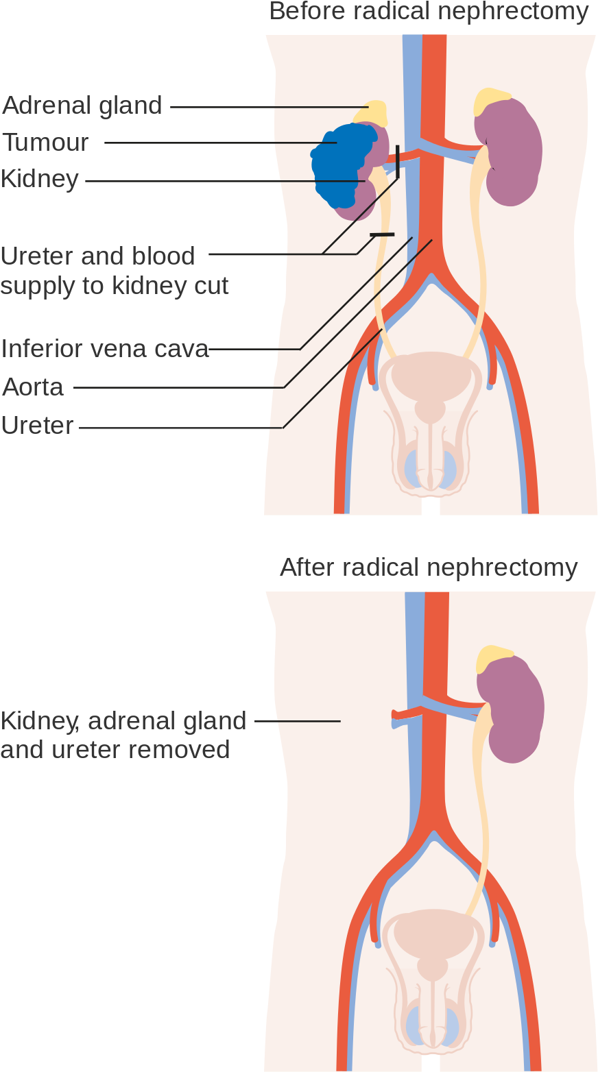 Open - Urology (1000x1672), Png Download