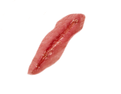 Scar (400x310), Png Download