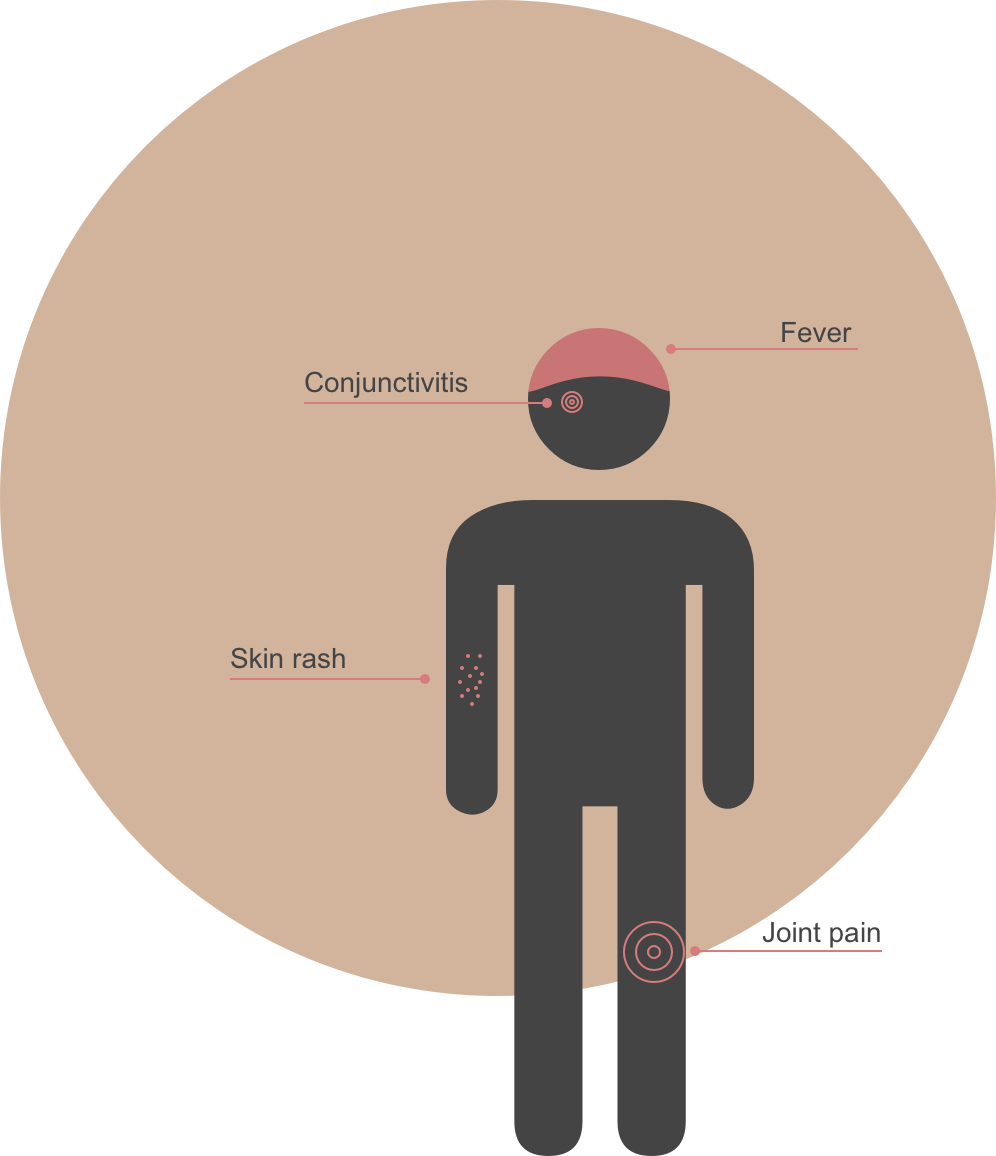 The World Health Organization Has Labeled The Zika - Circle (996x1156), Png Download