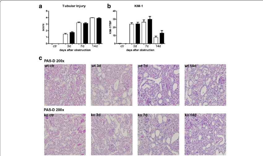 Renal Injury In Wt And Nod1/2 Dko (black Bars) Mice - Common Fig (850x504), Png Download