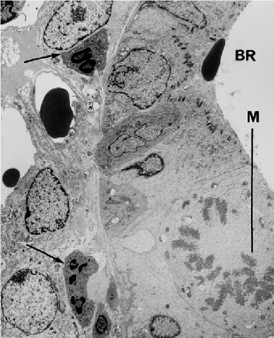 Em Of An Area Near The End Of A Bronchiole After Coexposure - Epithelium (720x703), Png Download