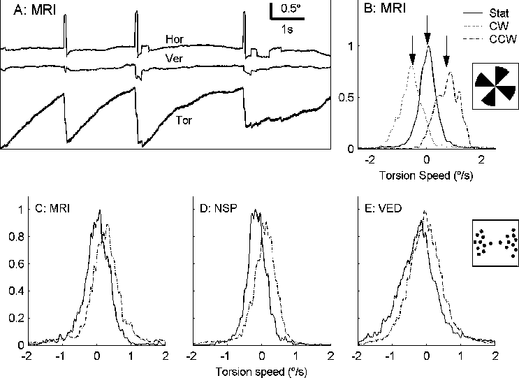 A E Eye Movements When Viewing Rotation - Diagram (743x541), Png Download