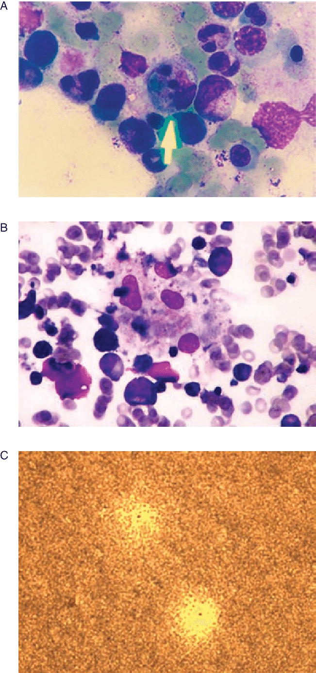 Light Microscope Image Showing Macrophages Phagocytizing - Microscope (651x1386), Png Download