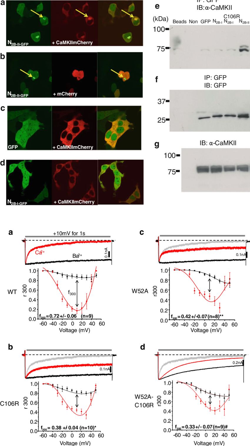 N Terminal C106 Residue Plays A Critical Role In Global - Cav1.2 (850x1516), Png Download