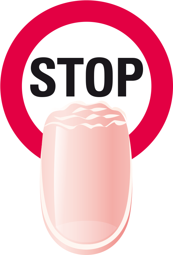 Banner Royalty Free Download Biting Nails Clipart (600x876), Png Download