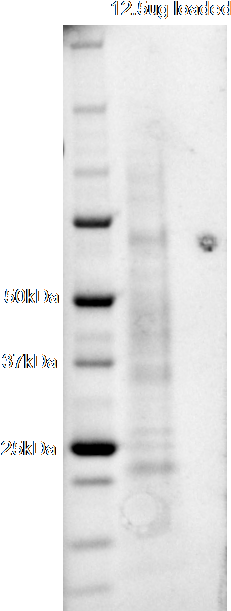 Sds Page Of Purified Protein - User Guide (265x648), Png Download