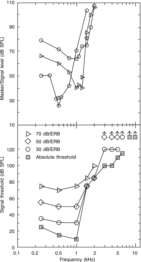 Results For A Person With A Dead Region At High Frequencies - Symbol (474x880), Png Download