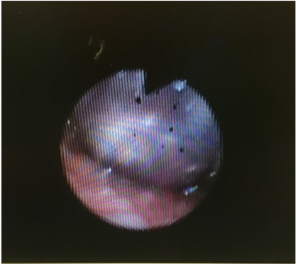 The Fiberoptic Was Placed In The Right Naris And Advanced - Light (903x371), Png Download