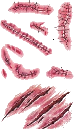 Zombie Scars (479x546), Png Download