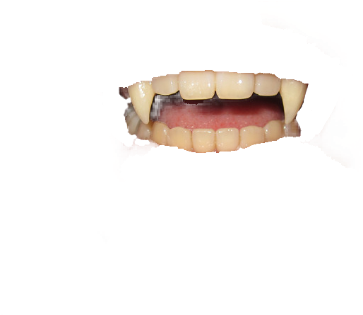 Dentures (624x444), Png Download