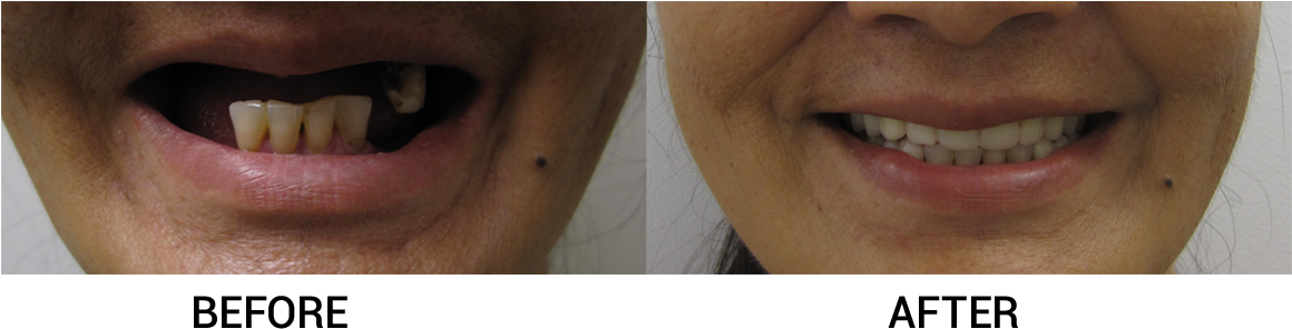Amm Has Restored The Smiles Of 56 Women To Date With - Close-up (1159x321), Png Download