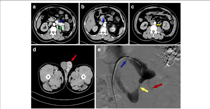Additional Radiological Examination Of The Patient - Common Fig (850x443), Png Download
