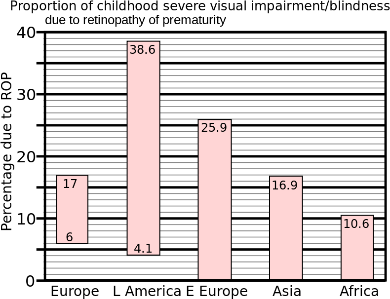 Retinopathy Of Prematurity In 1997 Was More Common - Retinopathy Of Prematurity (800x640), Png Download