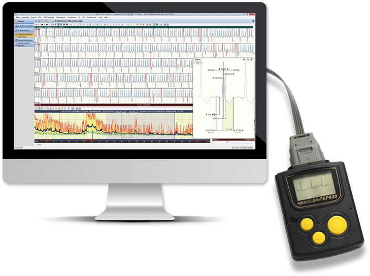 Holter Ecg - Computer Monitor (750x800), Png Download