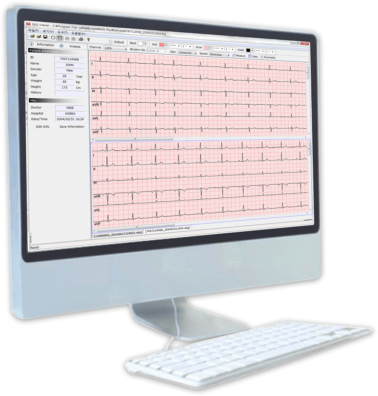 Bms-plus Bionet Ekg/ecg/spirometer Software - Software (2000x2000), Png Download