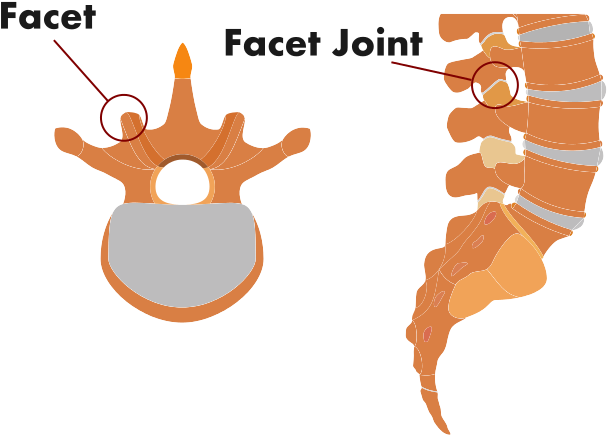 Facet Joint, Spinal Injury, Facet Joint Injury, Where - Pain In Spine (976x496), Png Download