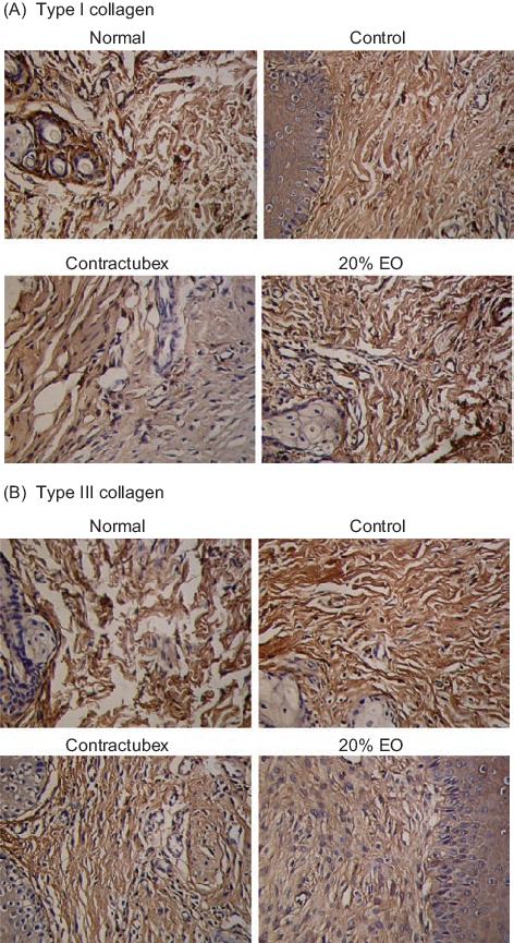 Immunohistochemical Reactivities Of Collagens I And - Granite (472x865), Png Download