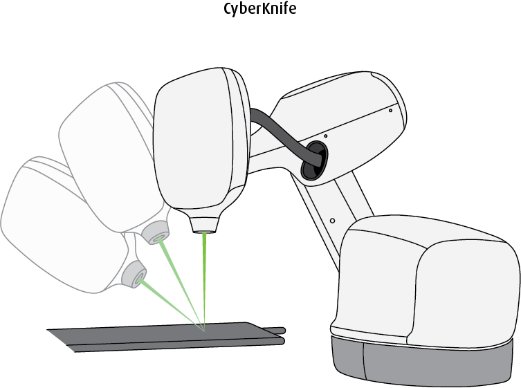 Gamma Knife Is Designed To Give External Radiation - Cyberknife (753x561), Png Download